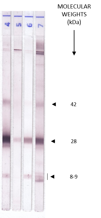 Fasciola Auswertung - LDBio