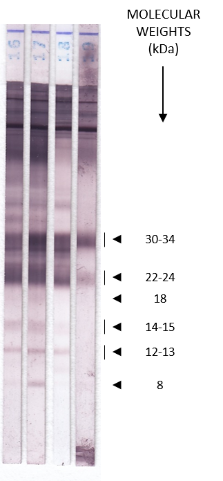 Schistosoma Auswertung - LDBio