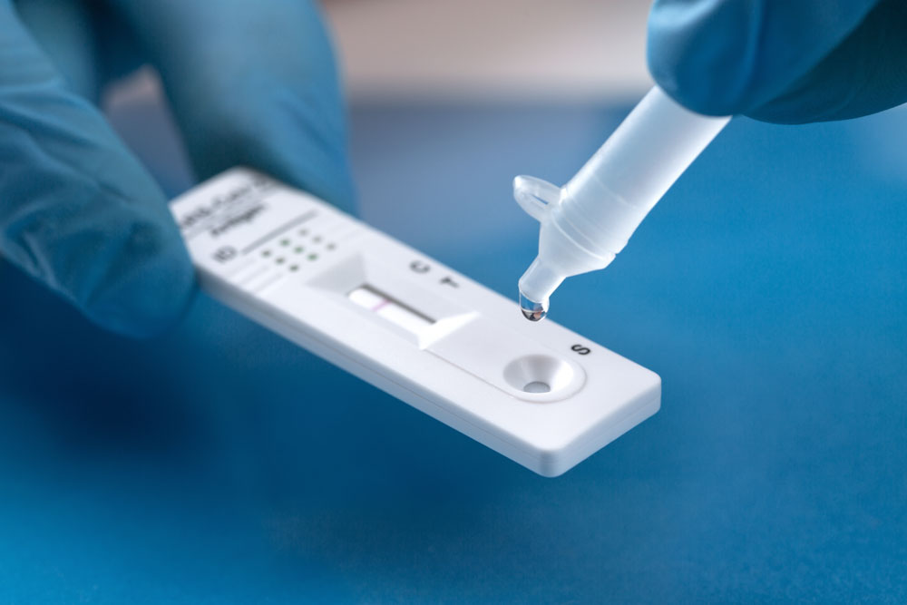 Kassettenschnelltest bei der Durchführung mit Tropffläschchen
