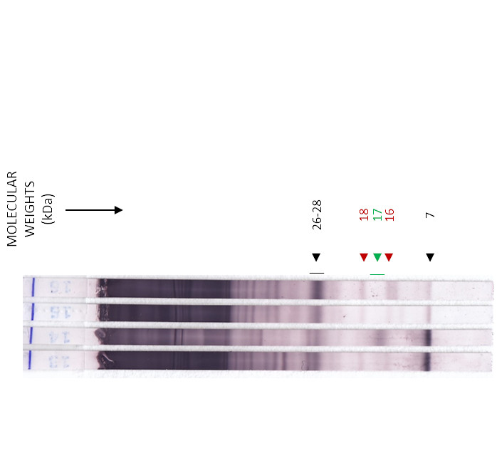 Echinococcus von LDBio - Auswertung