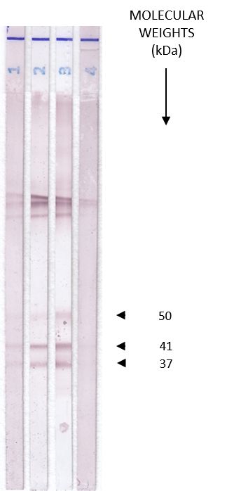 Trichinella Auswertung - LDBio
