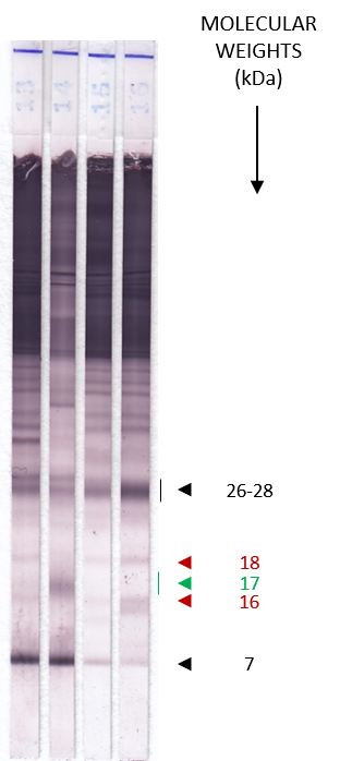 Echinococcus Auswertung - LDBio