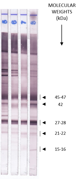 Chagas Auswertung - LDBio