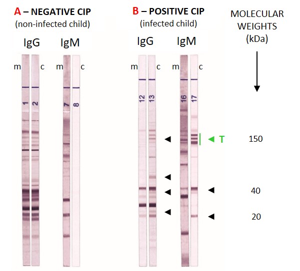 Toxoplasma Auswertung - LDBio