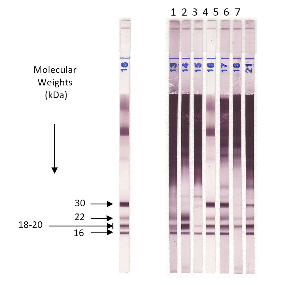 Aspergillus Auswertung - LDBio