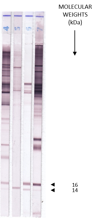 Leishmaniose Auswertung - LDBio